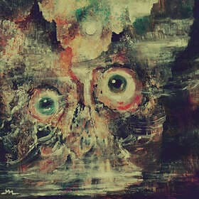 Teratoma Purulent Manifestations LP