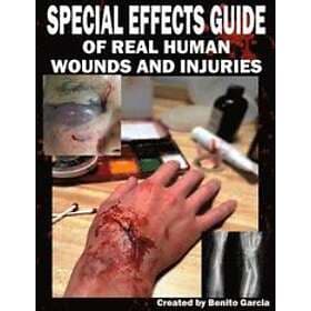 Benito Garcia III: Special Effects Guide Of Real Human Wounds and Injuries: Inju